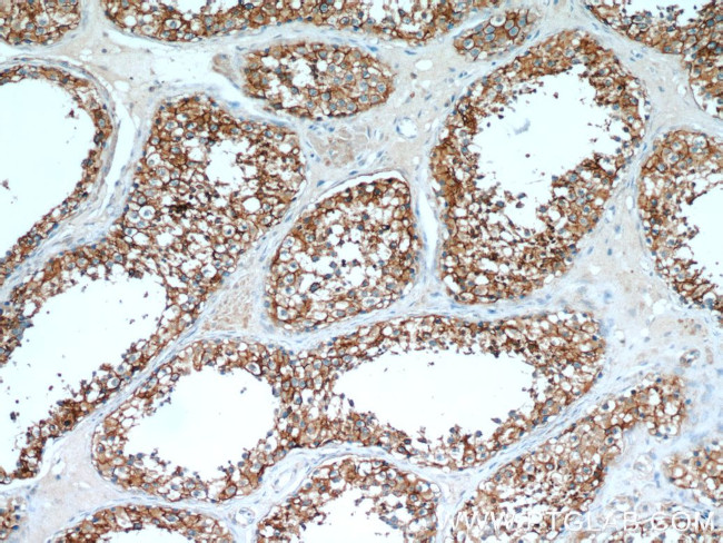 CCP1 Antibody in Immunohistochemistry (Paraffin) (IHC (P))