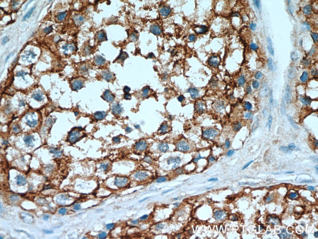 CCP1 Antibody in Immunohistochemistry (Paraffin) (IHC (P))