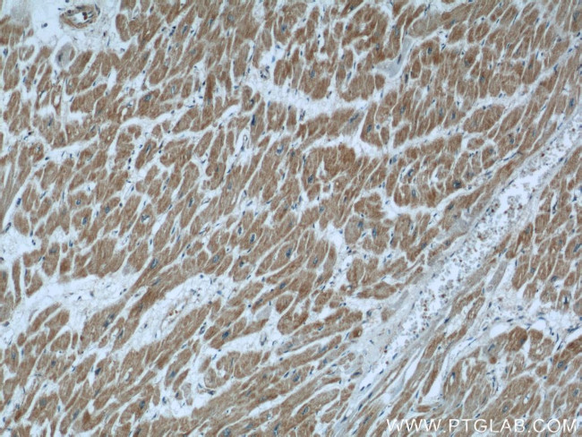 CCP1 Antibody in Immunohistochemistry (Paraffin) (IHC (P))