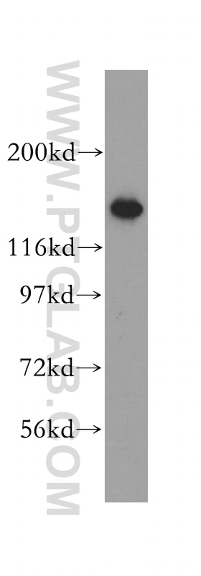 CCP1 Antibody in Western Blot (WB)