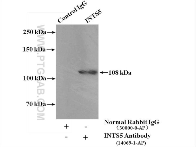 INTS5 Antibody in Immunoprecipitation (IP)