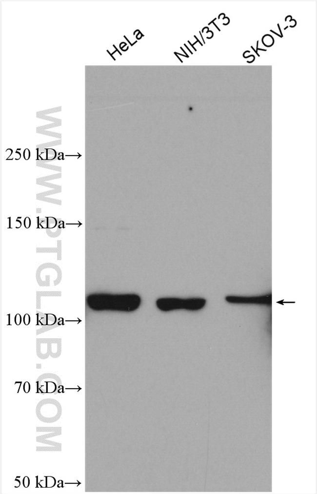 INTS5 Antibody in Western Blot (WB)