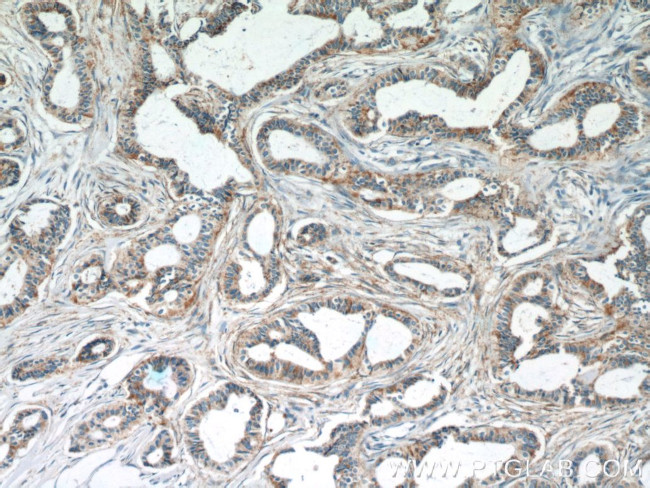 SRPK1 Antibody in Immunohistochemistry (Paraffin) (IHC (P))