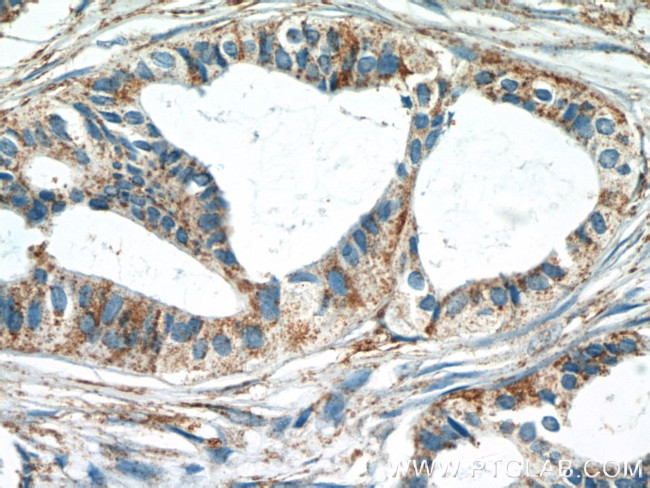 SRPK1 Antibody in Immunohistochemistry (Paraffin) (IHC (P))