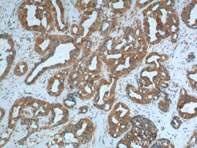 SRPK1 Antibody in Immunohistochemistry (Paraffin) (IHC (P))