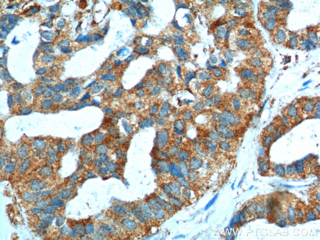 SRPK1 Antibody in Immunohistochemistry (Paraffin) (IHC (P))