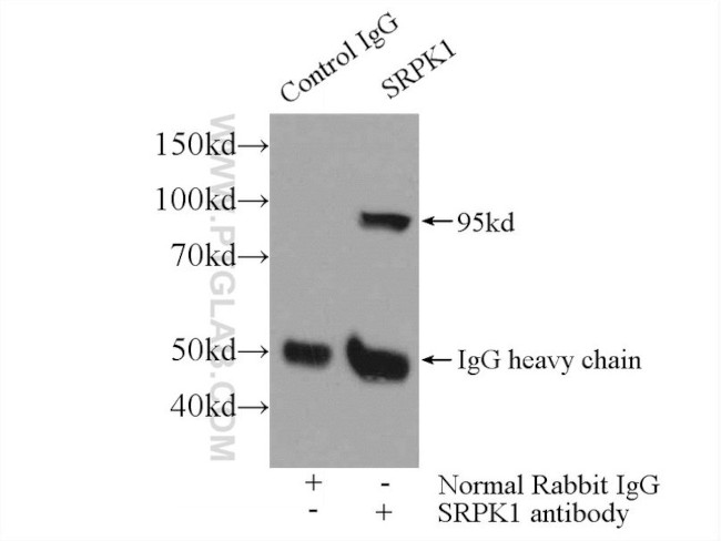 SRPK1 Antibody in Immunoprecipitation (IP)