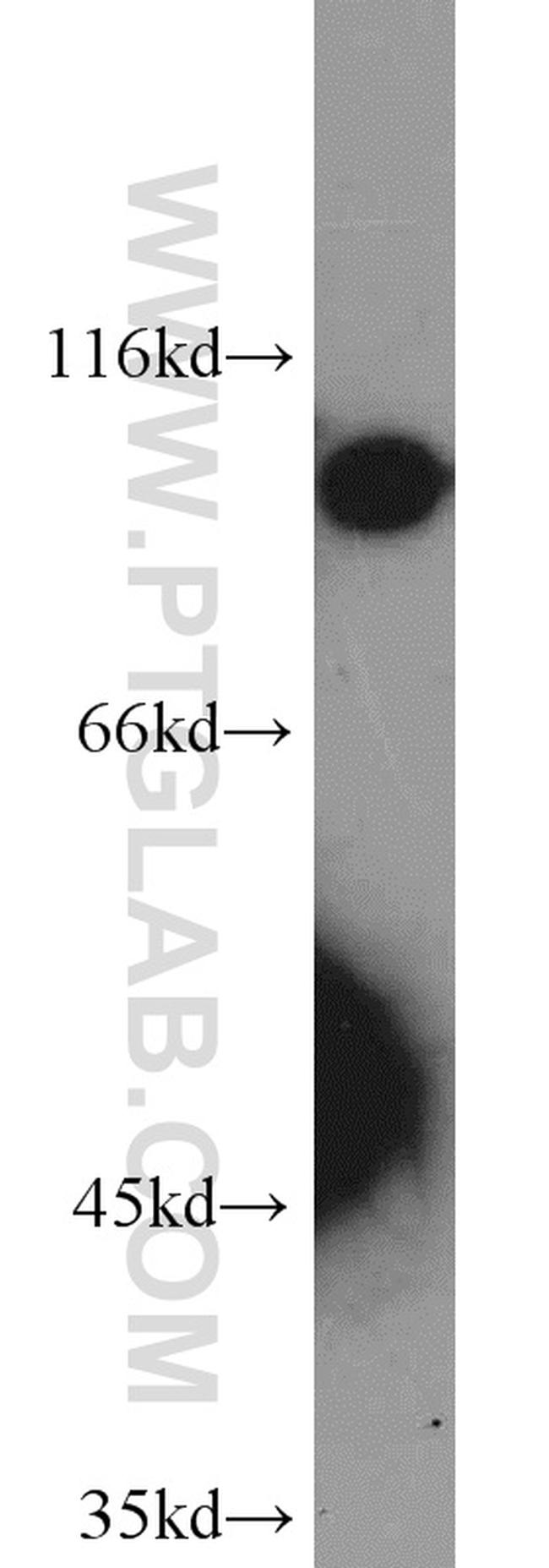 SRPK1 Antibody in Western Blot (WB)