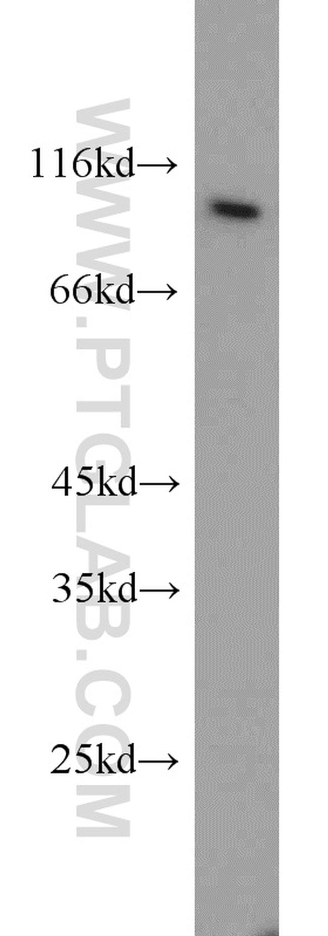 SRPK1 Antibody in Western Blot (WB)