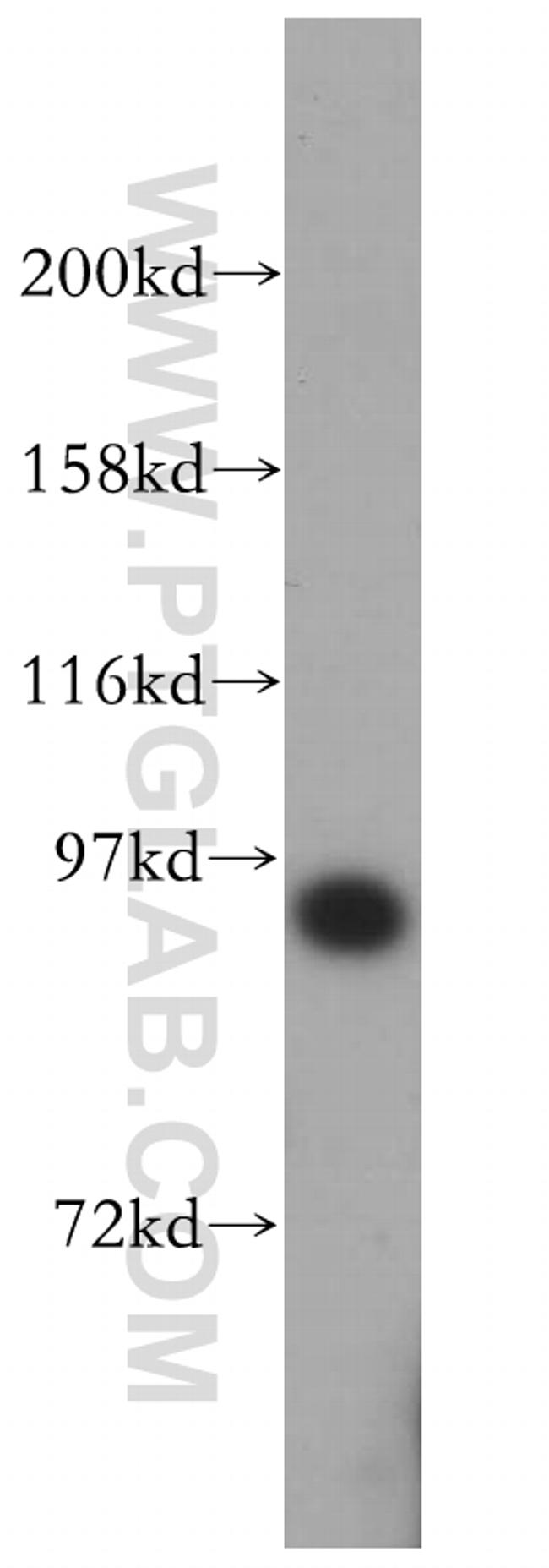 SRPK1 Antibody in Western Blot (WB)