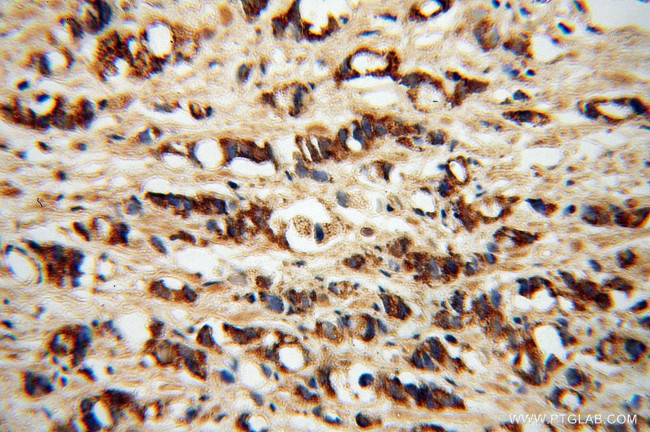 PDGFD Antibody in Immunohistochemistry (Paraffin) (IHC (P))