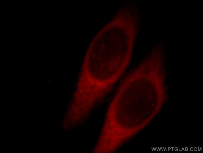 GNL1 Antibody in Immunocytochemistry (ICC/IF)