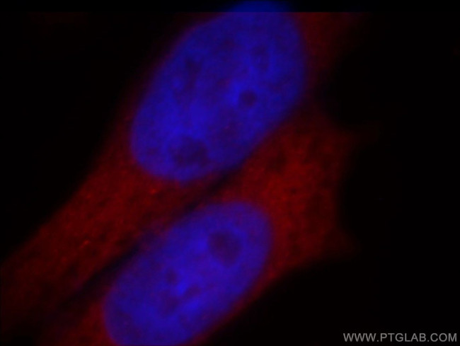 GNL1 Antibody in Immunocytochemistry (ICC/IF)