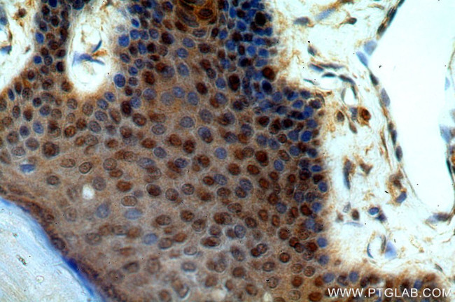 GNL1 Antibody in Immunohistochemistry (Paraffin) (IHC (P))