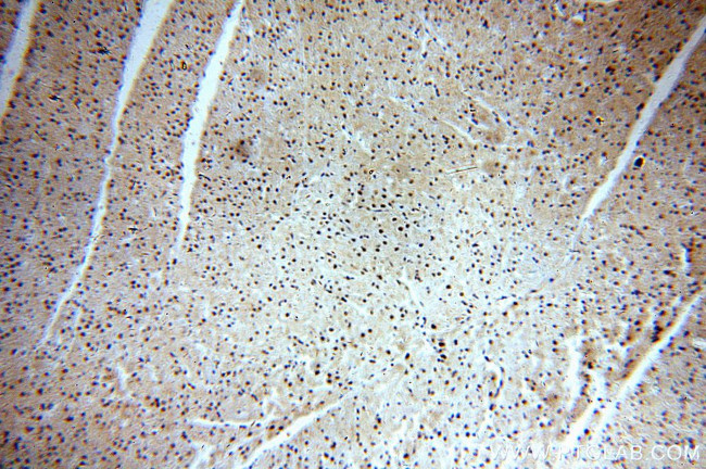 GNL1 Antibody in Immunohistochemistry (Paraffin) (IHC (P))