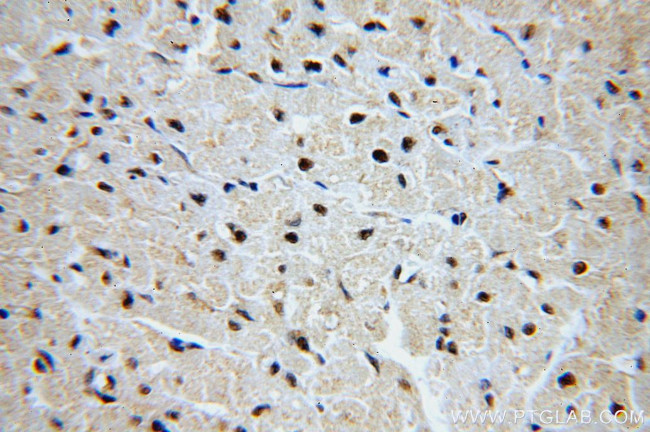 GNL1 Antibody in Immunohistochemistry (Paraffin) (IHC (P))