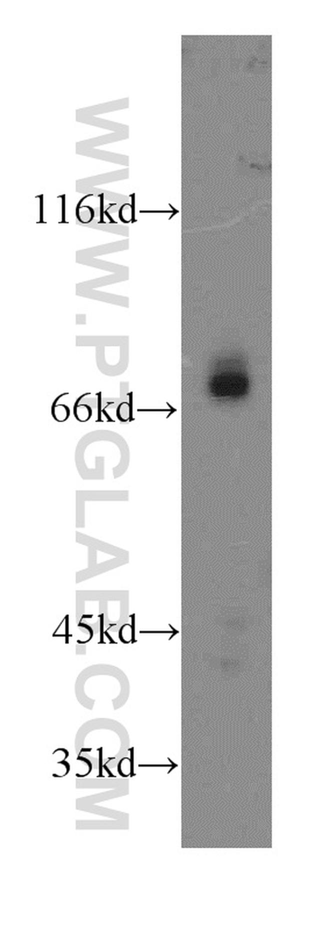 GNL1 Antibody in Western Blot (WB)