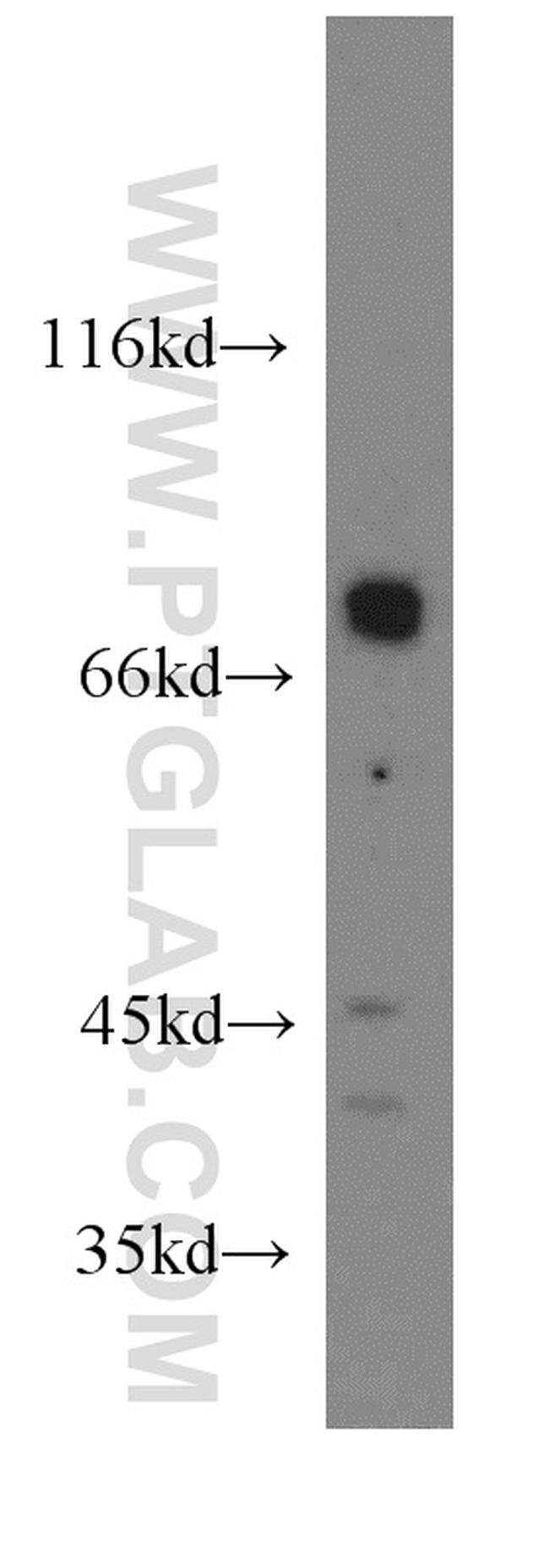 GNL1 Antibody in Western Blot (WB)