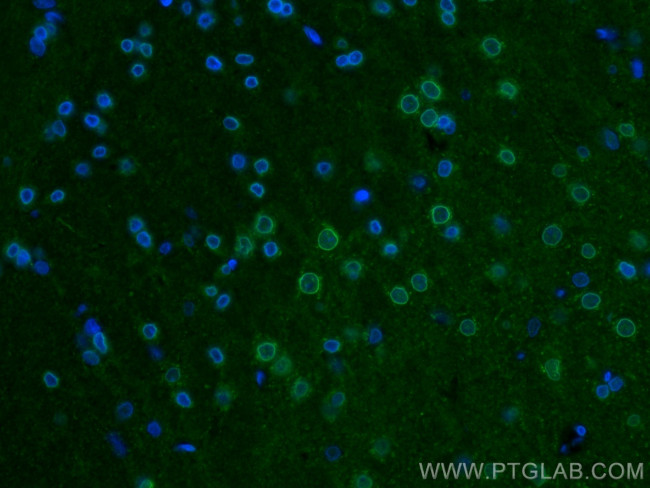 Kv1.3 Antibody in Immunohistochemistry (PFA fixed) (IHC (PFA))