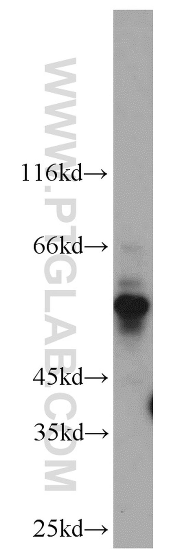 Kv1.3 Antibody in Western Blot (WB)