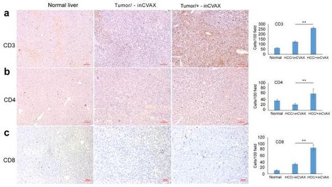 CD8a Antibody in Immunohistochemistry (IHC)