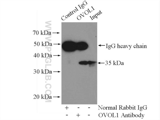 OVOL1 Antibody in Immunoprecipitation (IP)