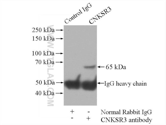 CNKSR3 Antibody in Immunoprecipitation (IP)