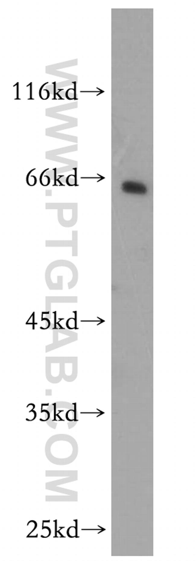 CNKSR3 Antibody in Western Blot (WB)