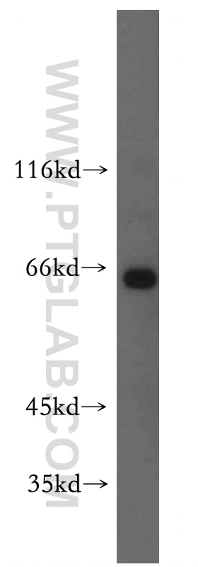 CNKSR3 Antibody in Western Blot (WB)