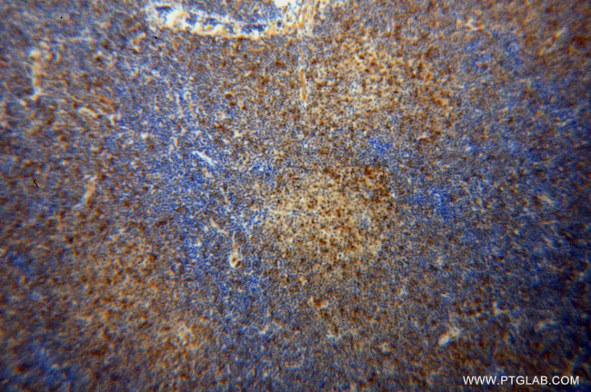 DOK2 Antibody in Immunohistochemistry (Paraffin) (IHC (P))