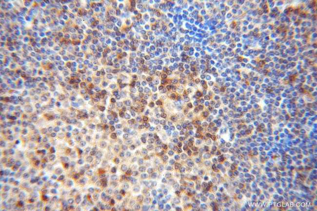 DOK2 Antibody in Immunohistochemistry (Paraffin) (IHC (P))