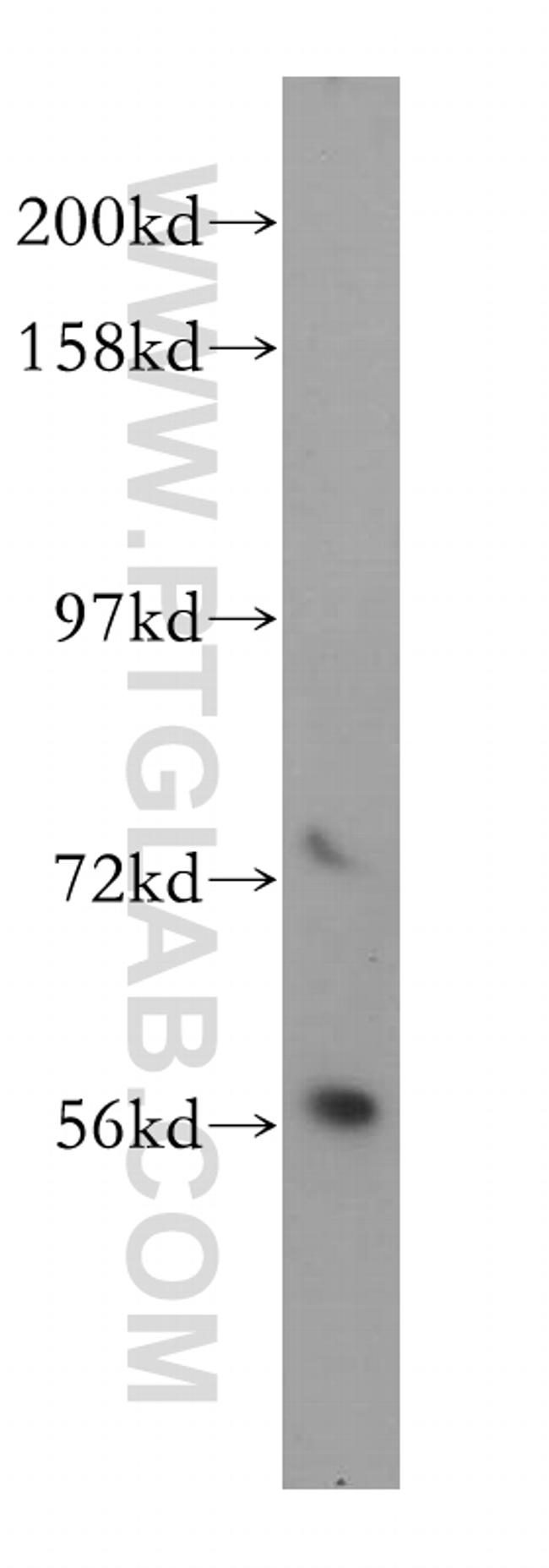 DOK2 Antibody in Western Blot (WB)