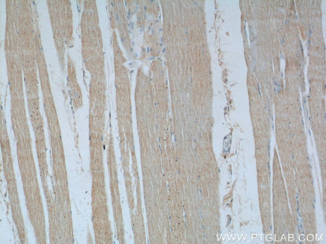 SREBF1 Antibody in Immunohistochemistry (Paraffin) (IHC (P))