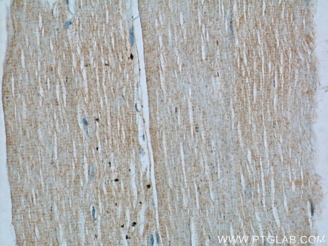 SREBF1 Antibody in Immunohistochemistry (Paraffin) (IHC (P))