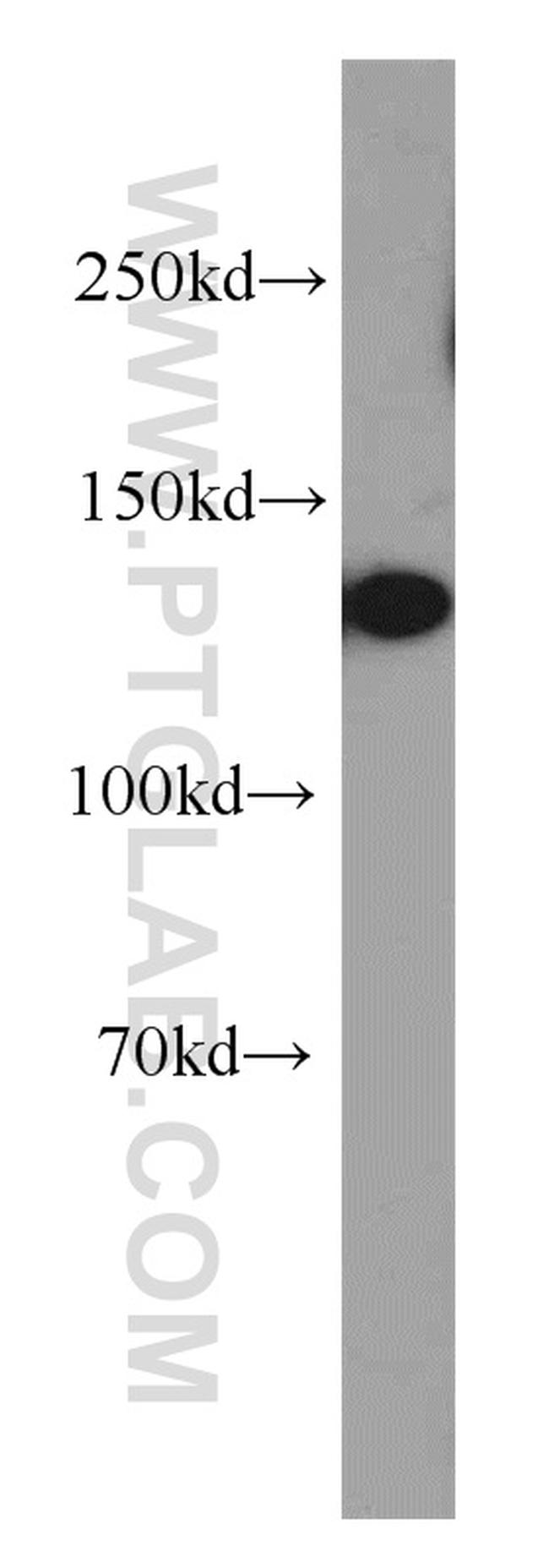 SREBF1 Antibody in Western Blot (WB)