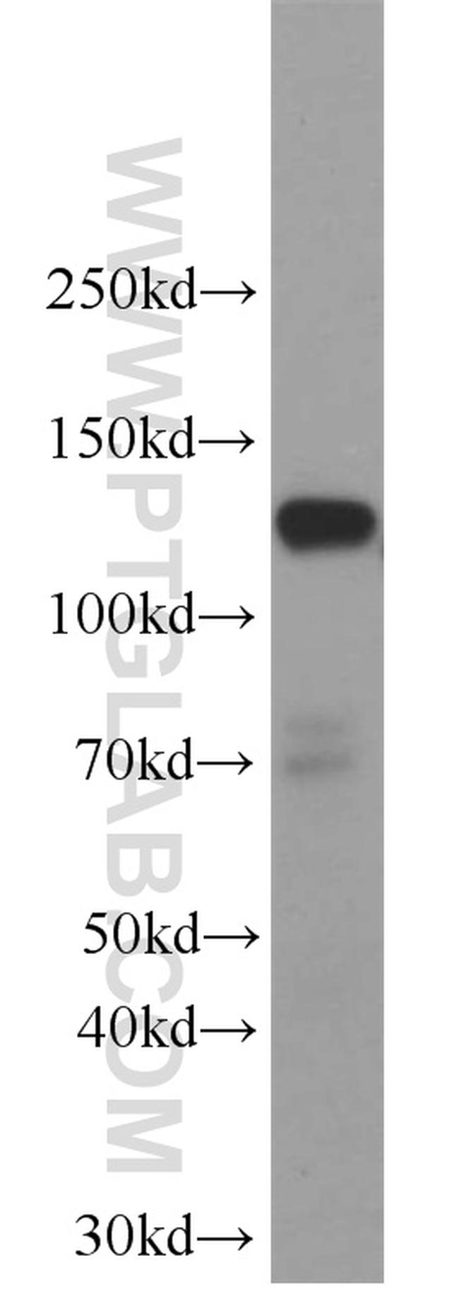 SREBF1 Antibody in Western Blot (WB)