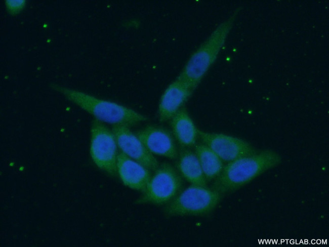 SREBF1 Antibody in Immunocytochemistry (ICC/IF)