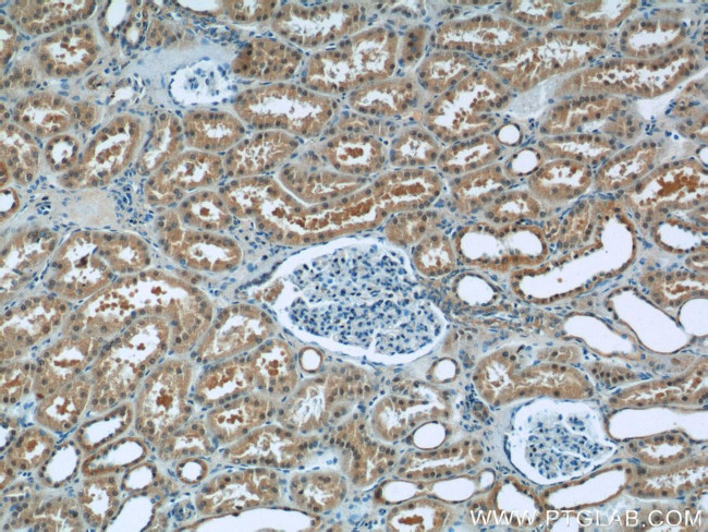 SREBF1 Antibody in Immunohistochemistry (Paraffin) (IHC (P))