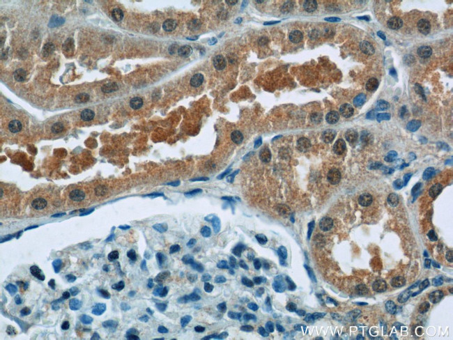 SREBF1 Antibody in Immunohistochemistry (Paraffin) (IHC (P))