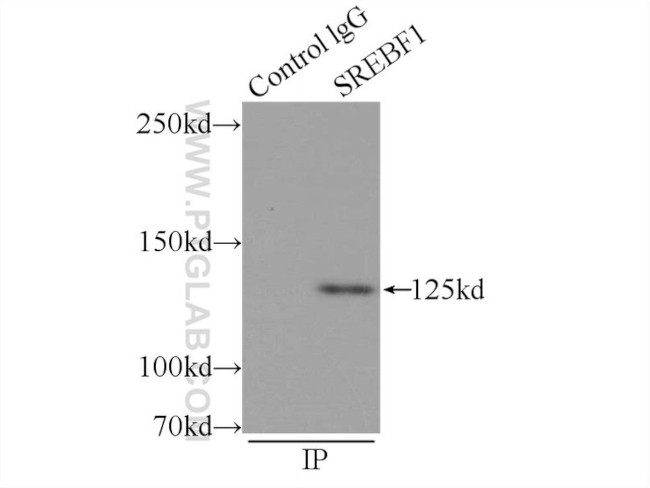 SREBF1 Antibody in Immunoprecipitation (IP)