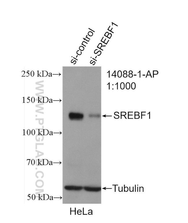 SREBF1 Antibody in Western Blot (WB)