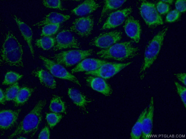 ARHGEF7 Antibody in Immunocytochemistry (ICC/IF)