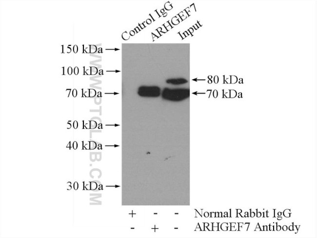 ARHGEF7 Antibody in Immunoprecipitation (IP)