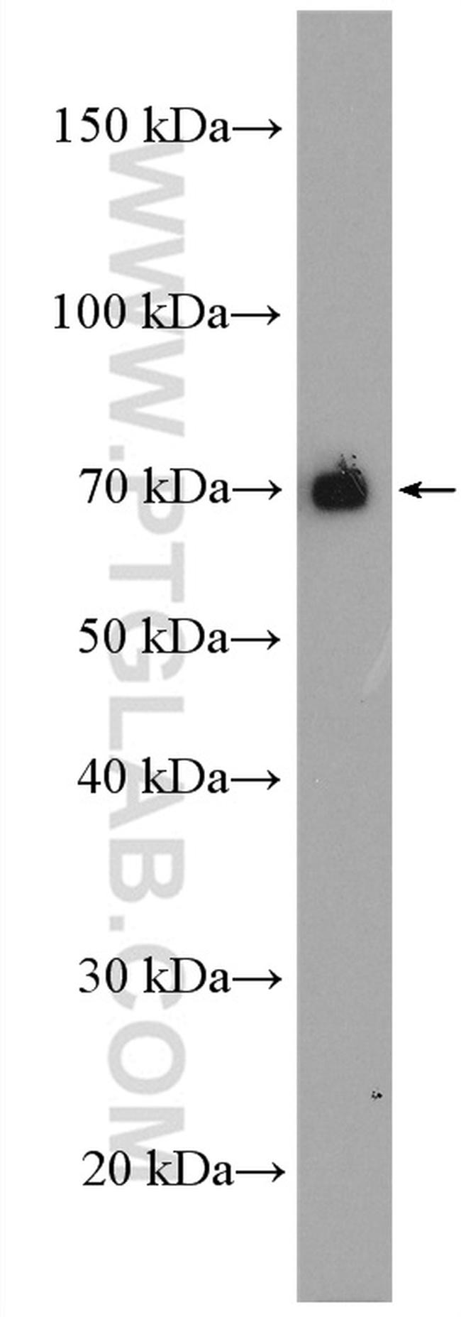 ARHGEF7 Antibody in Western Blot (WB)