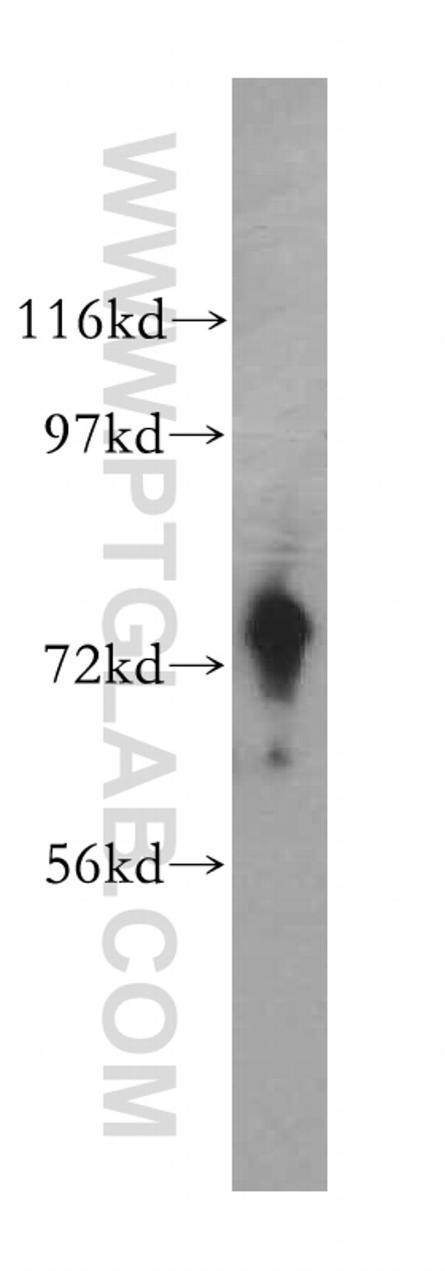 ARHGEF7 Antibody in Western Blot (WB)