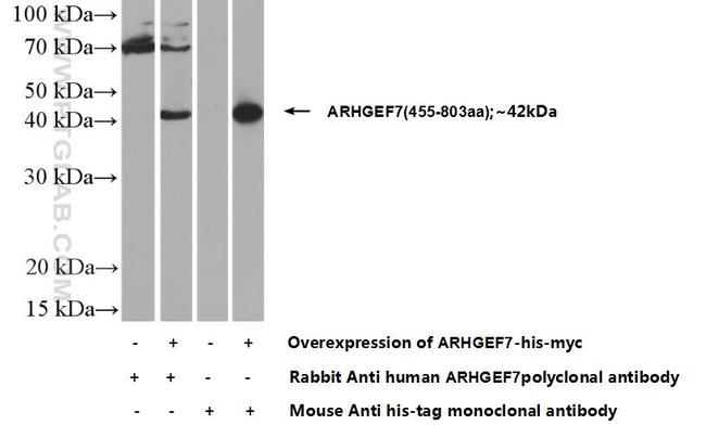 ARHGEF7 Antibody in Western Blot (WB)