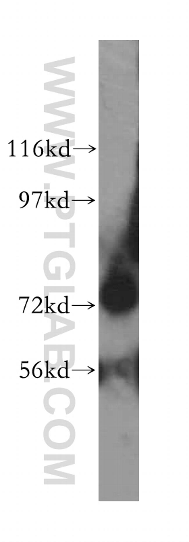 ARHGEF7 Antibody in Western Blot (WB)