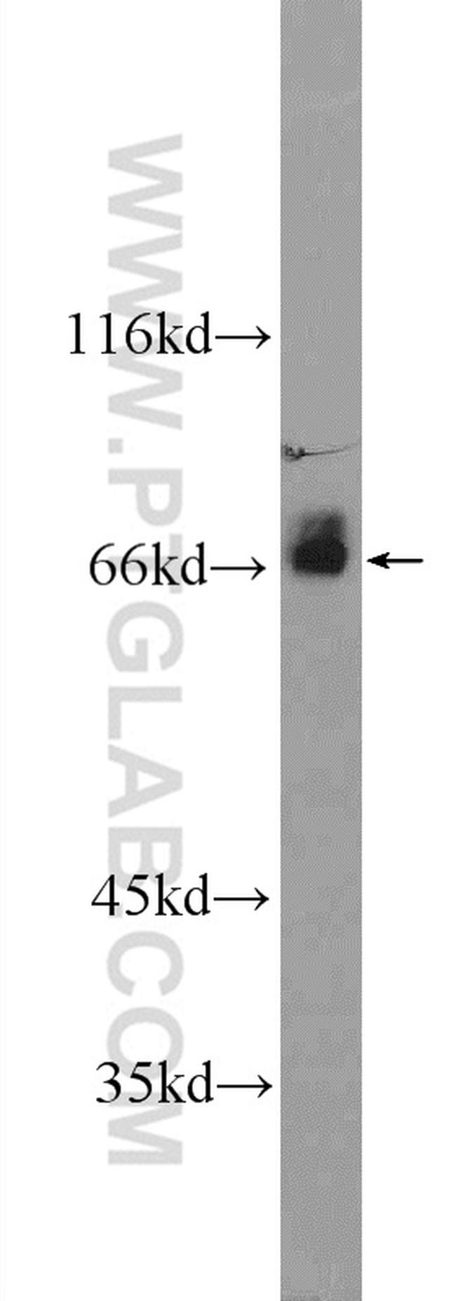 ARHGEF7 Antibody in Western Blot (WB)