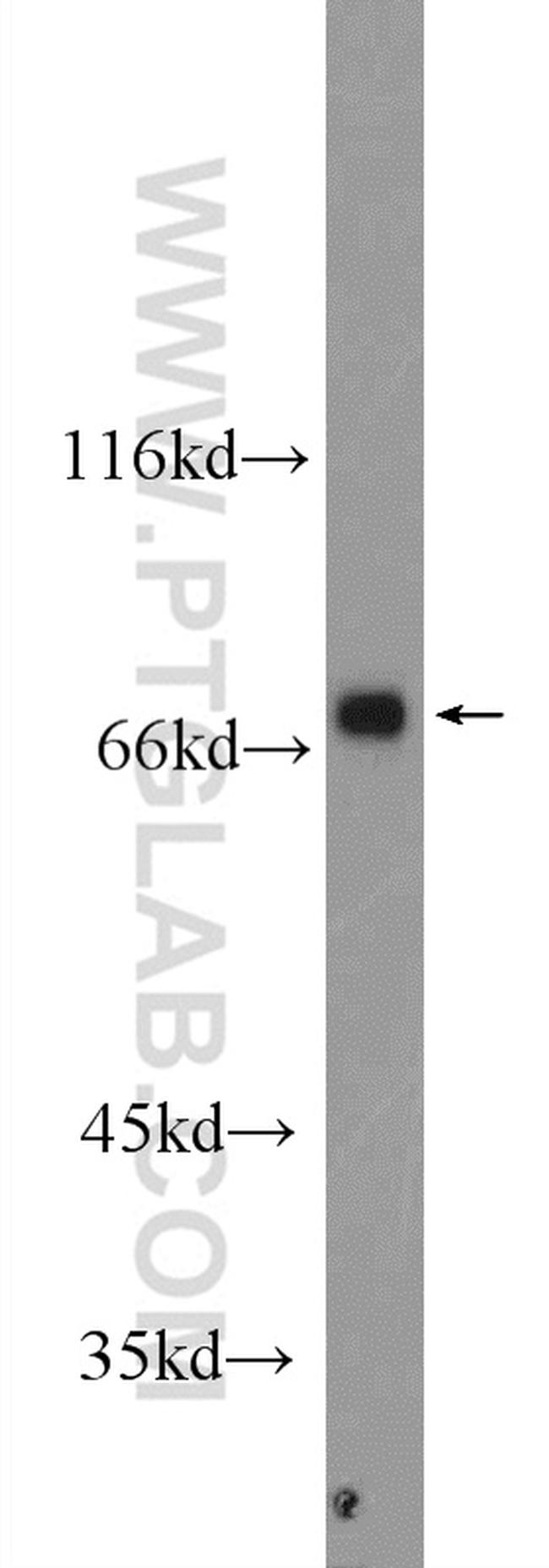 ARHGEF7 Antibody in Western Blot (WB)