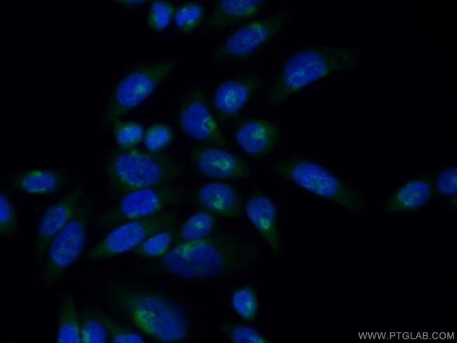 ACBD3 Antibody in Immunocytochemistry (ICC/IF)